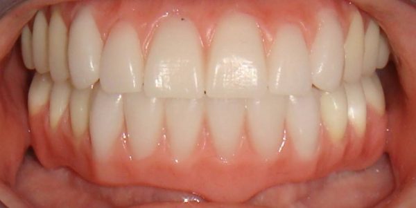 A Northwood Dental patient with an attractive restored smile.