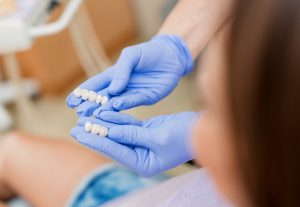 dentist showing patient dental bridges